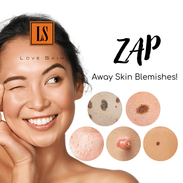 [S190054 - 10] Zap Away Skin BLEMISHES! Say Good bye to Seborrheic keratosis, Solar Lentigo (aka Liver spots/ Age spots), Milia seeds (aka Oil seeds), Skin Tags, and Moles