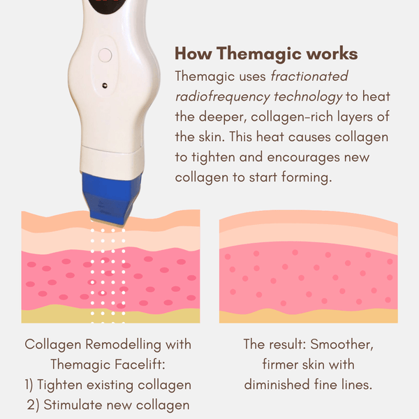Themagic Face Treatment Plan - 6 Intensive Skin Tightening Treatments: Tighten, Lift, and Transform your skin FREE 3 Anti - aging Serums
