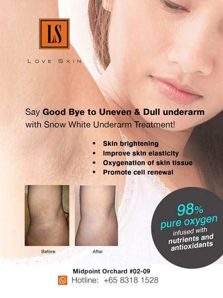 [S190036 - 30] Snow White Underarm Treatment - Brighten, Hydrate, Smooth & FRESH!