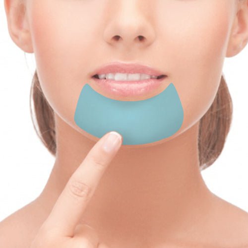[S190041 - 5] Chin IPL Hair Removal – Say GOOD BYE to waxing and shaving!