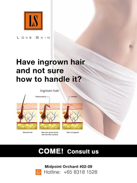 [S190057 - 15] Brazilian Ingrown Hair Extraction